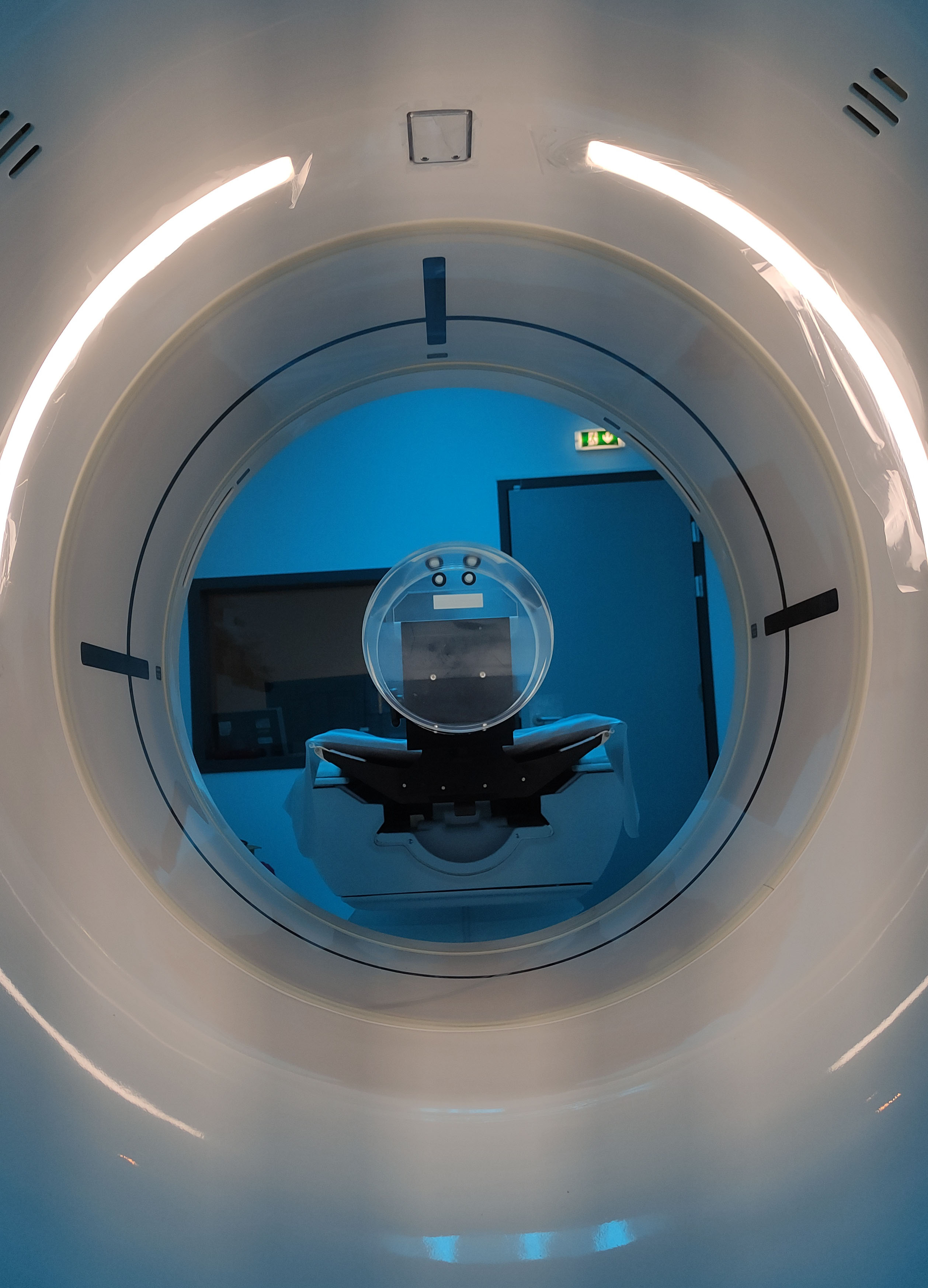 CT Scan Revolution
